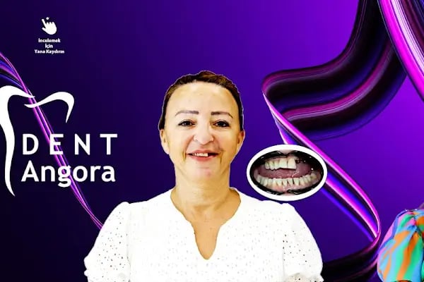Dentangora 100. Yıl Şubesi Ağız ve Diş Sağlığı Polikliniği - Resim 20