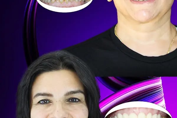 Dentangora 100. Yıl Şubesi Ağız ve Diş Sağlığı Polikliniği - Resim 16