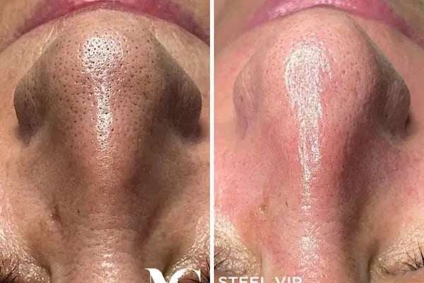İnegöl Mç Steel Vip - Resim 17