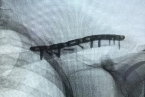 İstanbul Ortopedik Tümör Cerrahisi Op. Dr. Selman Doğan - Resim 10