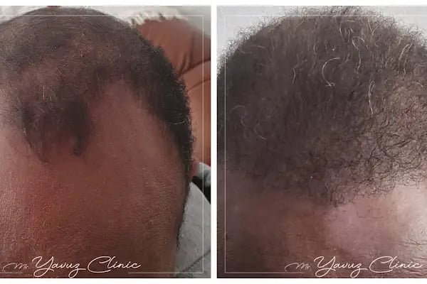 Evolve Hair Center - Resim 13