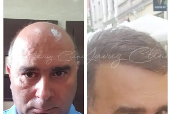 Evolve Hair Center - Resim 15