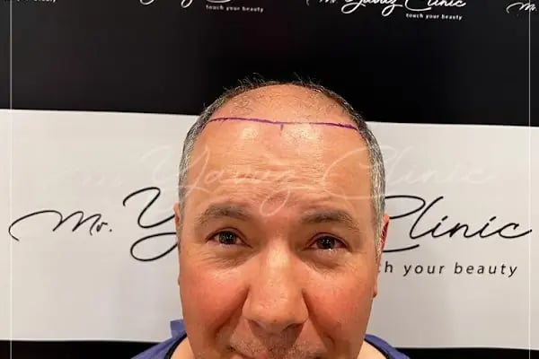 Evolve Hair Center - Resim 7