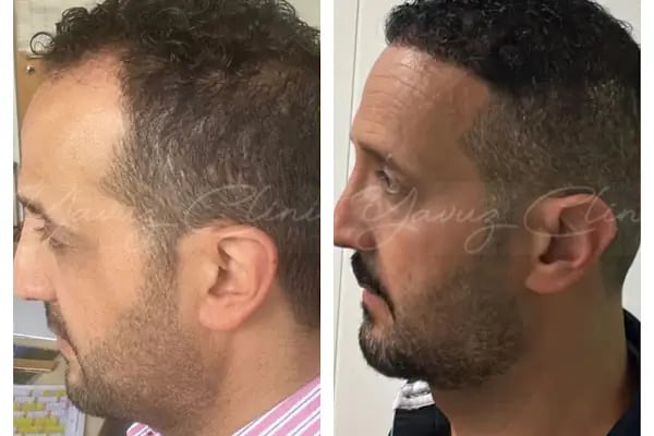 Evolve Hair Center - Resim 14