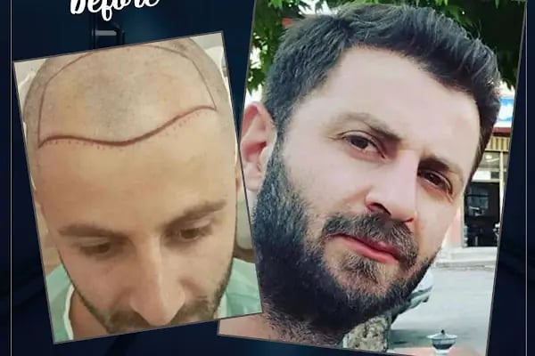 Evolve Hair Center - Resim 16