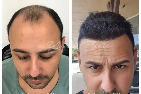 Evolve Hair Center - Resim 10
