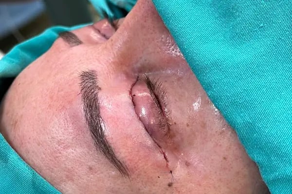 Op. Dr. Ufuk ÜRDEM Göz Hastalıkları ve Cerrahisi Uzmanı. Lazer, Akıllı Lens, Göz Kapağı Estetiği, Şaşılık, Katarakt - Resim 19