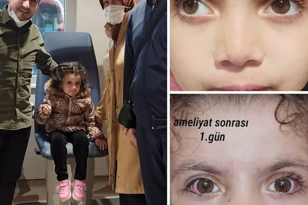 Op. Dr. Ufuk ÜRDEM Göz Hastalıkları ve Cerrahisi Uzmanı. Lazer, Akıllı Lens, Göz Kapağı Estetiği, Şaşılık, Katarakt - Resim 20