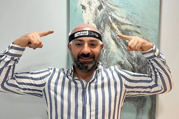 Cap Hair Clinic İstanbul - Resim 7