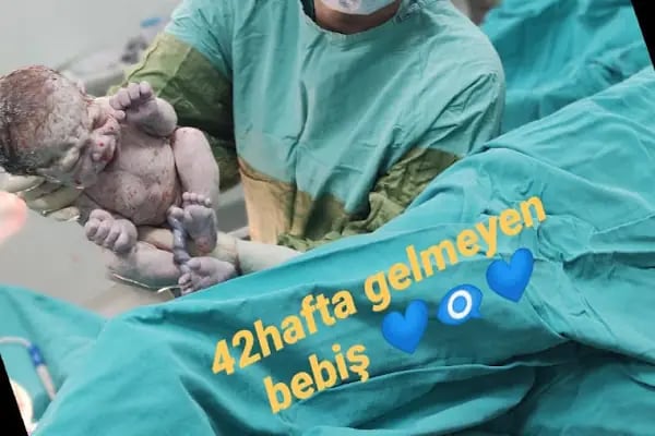 Op. Dr. Sevgi YILDIRIM ALTA - Resim 17