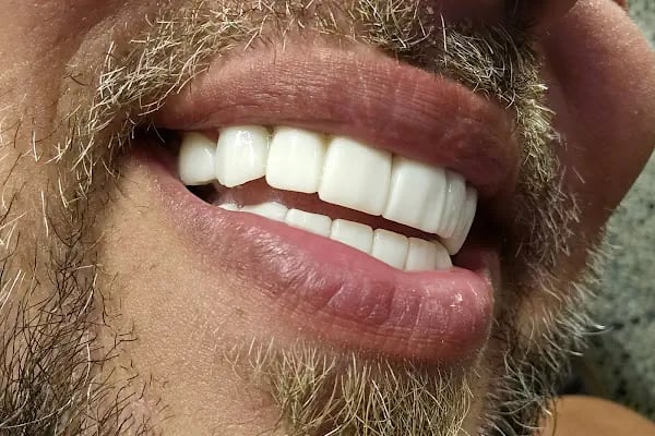 All Dental Alanya - Resim 9