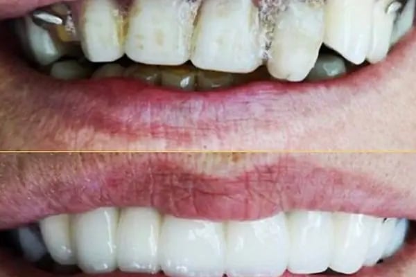 All Dental Alanya - Resim 7