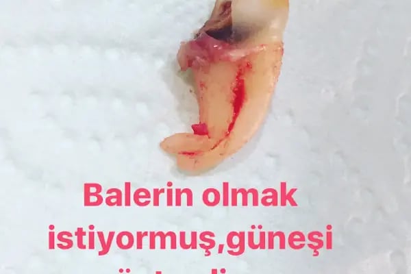Dt. Recep Balkaya Diş Kliniği - Resim 12