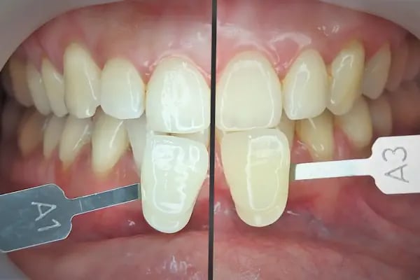 ( STRONGDENTAL) Özel Güçlü Ağız ve Diş Sağlığı Polikliniği - Resim 17