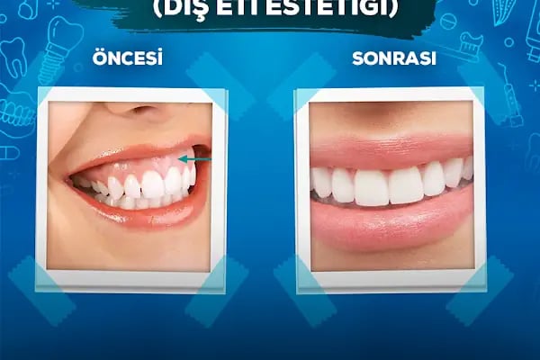 Özel Ada Palmiye Ağız Ve Diş Sağlığı Polikliniği - Resim 5