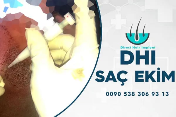 Akdeniz Antalya Saç Ekimi - Hair Transplant Antalya - Resim 9