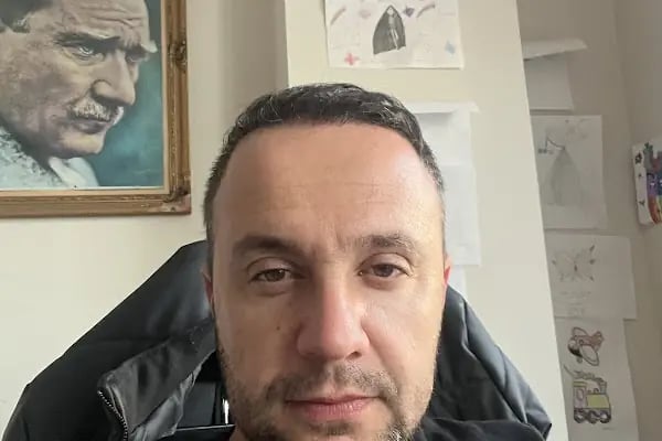 Akdeniz Antalya Saç Ekimi - Hair Transplant Antalya - Resim 4