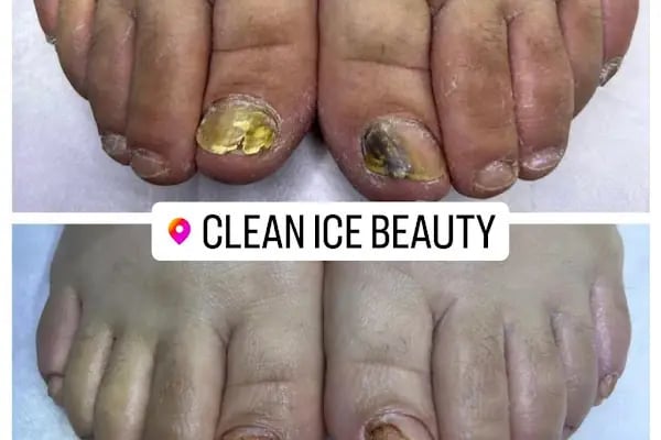 CleanICE Beauty - Resim 14