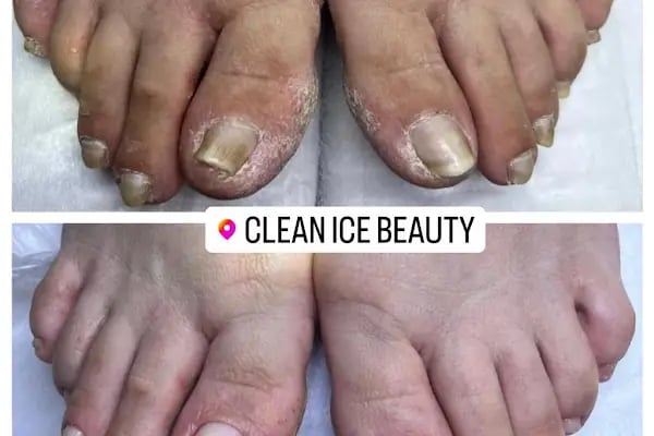 CleanICE Beauty - Resim 16