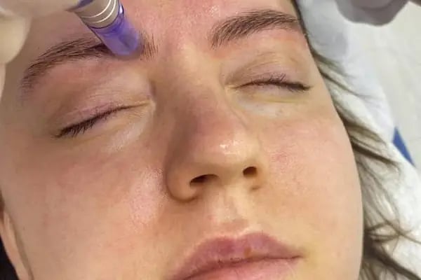 CleanICE Beauty - Resim 11