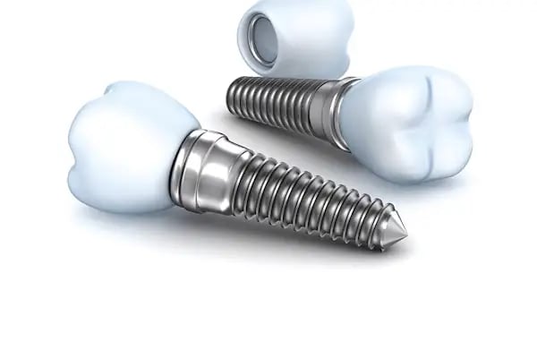 DENTVAN AĞIZ VE DİŞ SAĞLIĞI POLİKLİNİĞİ - Resim 9