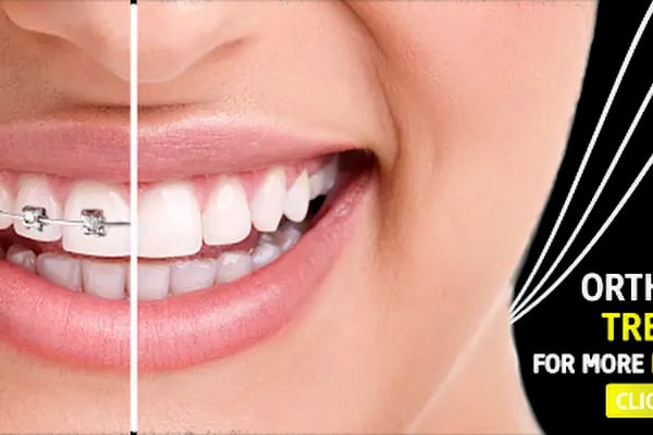 DENTVAN AĞIZ VE DİŞ SAĞLIĞI POLİKLİNİĞİ - Resim 10