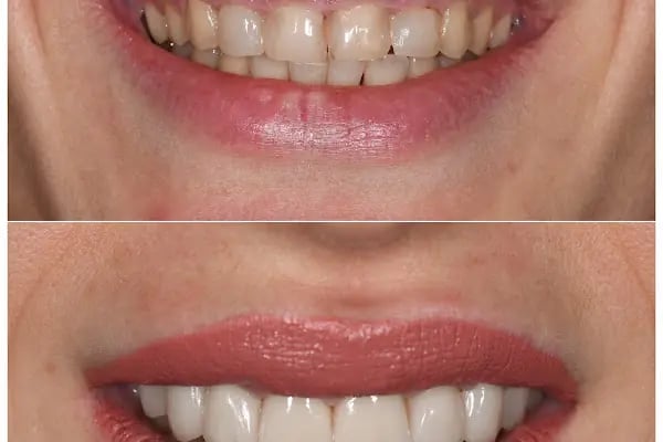 MAYA Dental Klinik - Resim 8