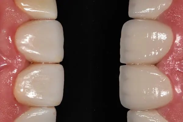 MAYA Dental Klinik - Resim 17