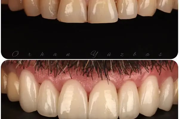 MAYA Dental Klinik - Resim 13