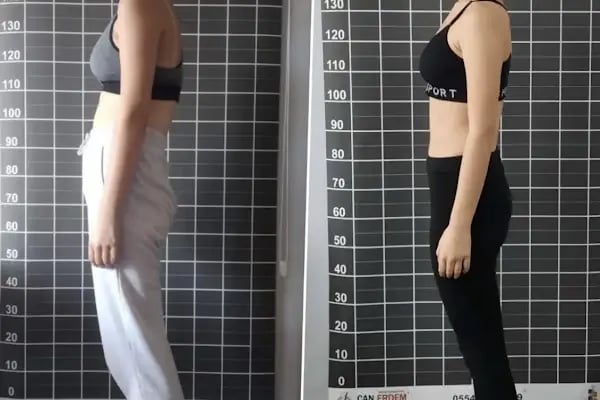 Eforfiz Sağlıklı Yaşam Merkezi - Resim 12