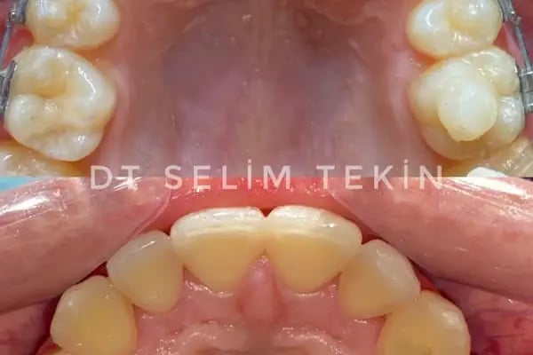 Diş Hekimi Selim Tekin - Resim 15