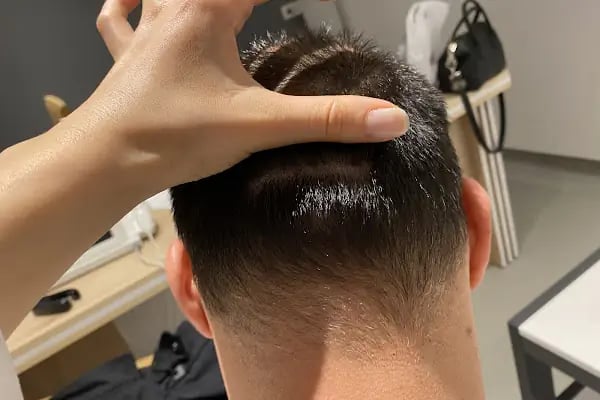 Prestige Hair Clinic - Resim 2