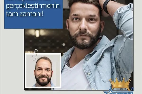 Alanya hairtransplant and prosthetic hair Center ( Alanya saç ekimi ve protez saç merkezi ) - Resim 6