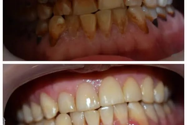 Dentanova Ağız ve Diş Sağlığı Polikliniği - Resim 5