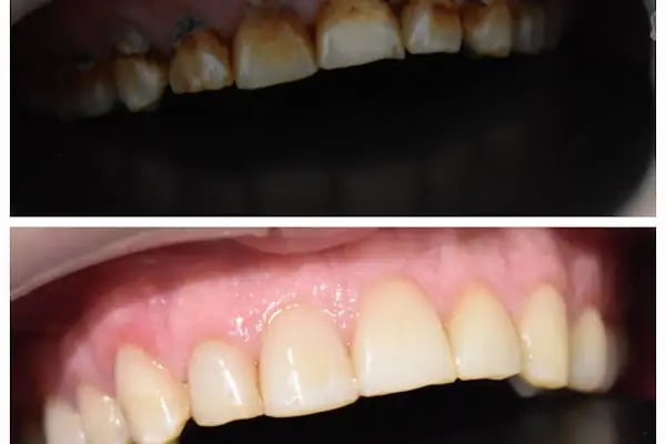 Dentanova Ağız ve Diş Sağlığı Polikliniği - Resim 6