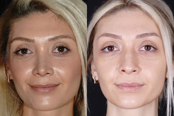 Op. Dr. Mert DEMİREL - Resim 9