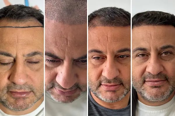 Clean Saç Ekim Merkezi - Resim 12