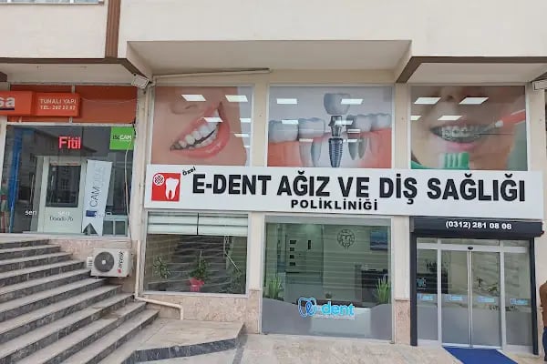 eDent Ağız ve Diş Sağlığı Polikliniği Eryaman - Resim 3