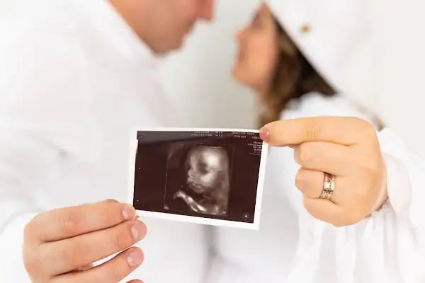 Limon Stüdyo Fotoğraf &amp; Video - Resim 17