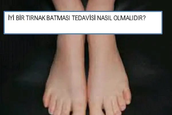 Op. Dr. Feza Köylüoğlu - Ortopedi Uzmanı - Resim 6