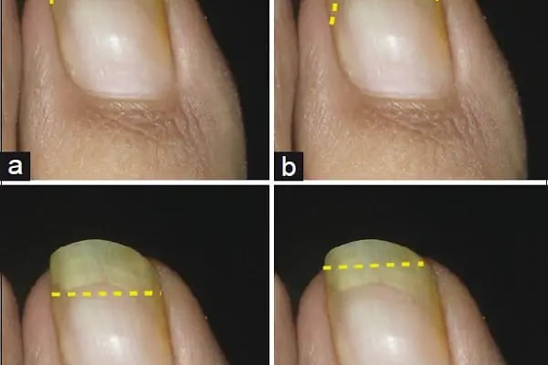 Op. Dr. Feza Köylüoğlu - Ortopedi Uzmanı - Resim 3