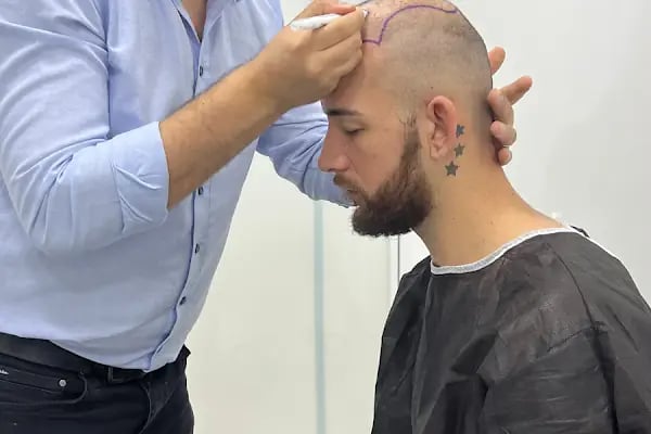 Adk Hair Transplant - Saç Ekimi - Resim 2