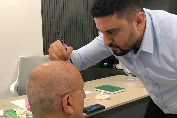 Adk Hair Transplant - Saç Ekimi - Resim 3