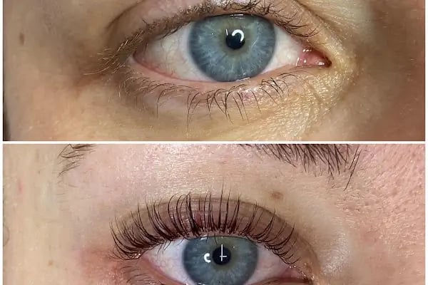 Ensari Beauty Center - Resim 19