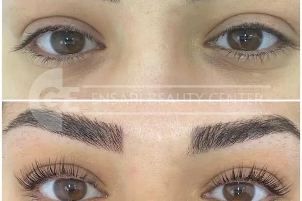 Ensari Beauty Center - Resim 18