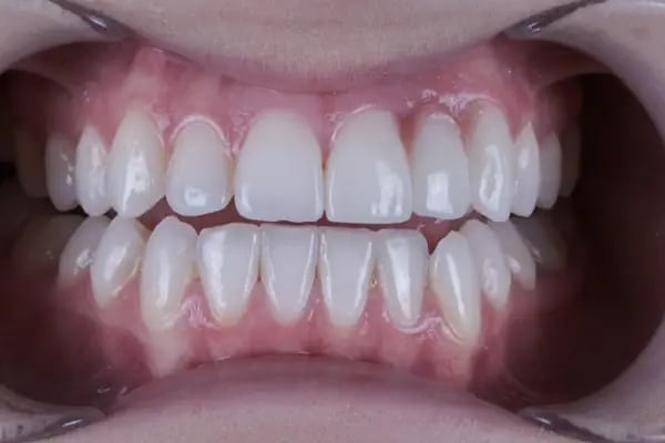 Dentomega İzmir İmplant Diş Polikliniği - Resim 9