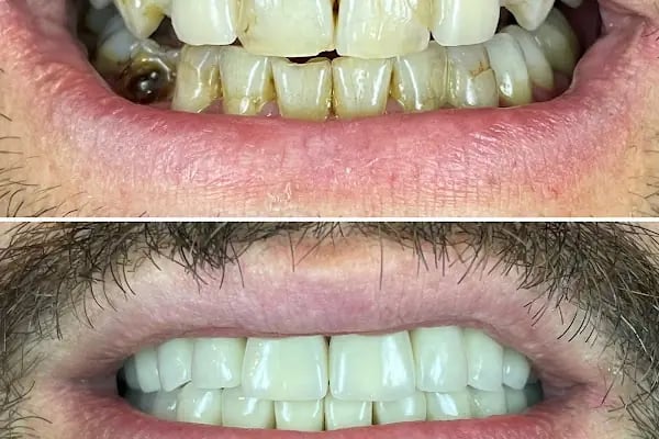 Dentomega İzmir İmplant Diş Polikliniği - Resim 7