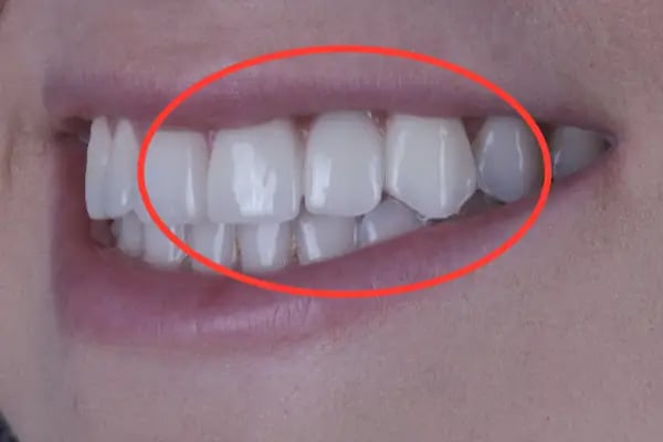 Dentomega İzmir İmplant Diş Polikliniği - Resim 6