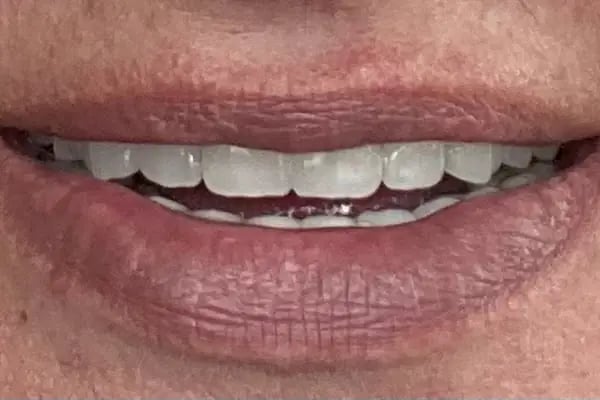 Dentomega İzmir İmplant Diş Polikliniği - Resim 12