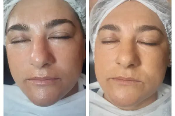 Bella fee güzellik salonu ve kuaför - Resim 15
